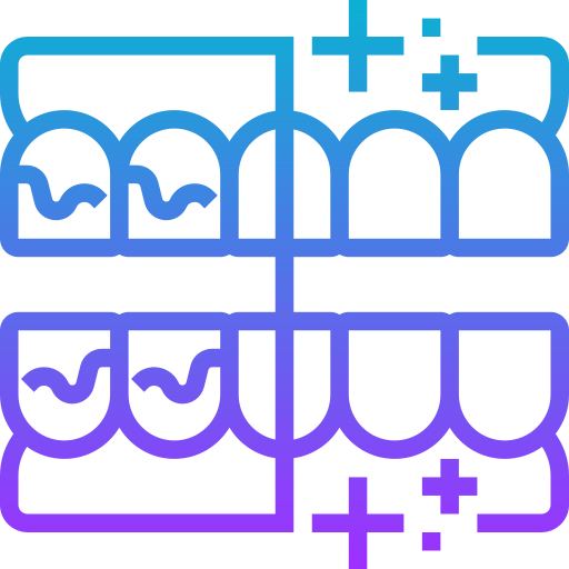 Teeth Alignment
